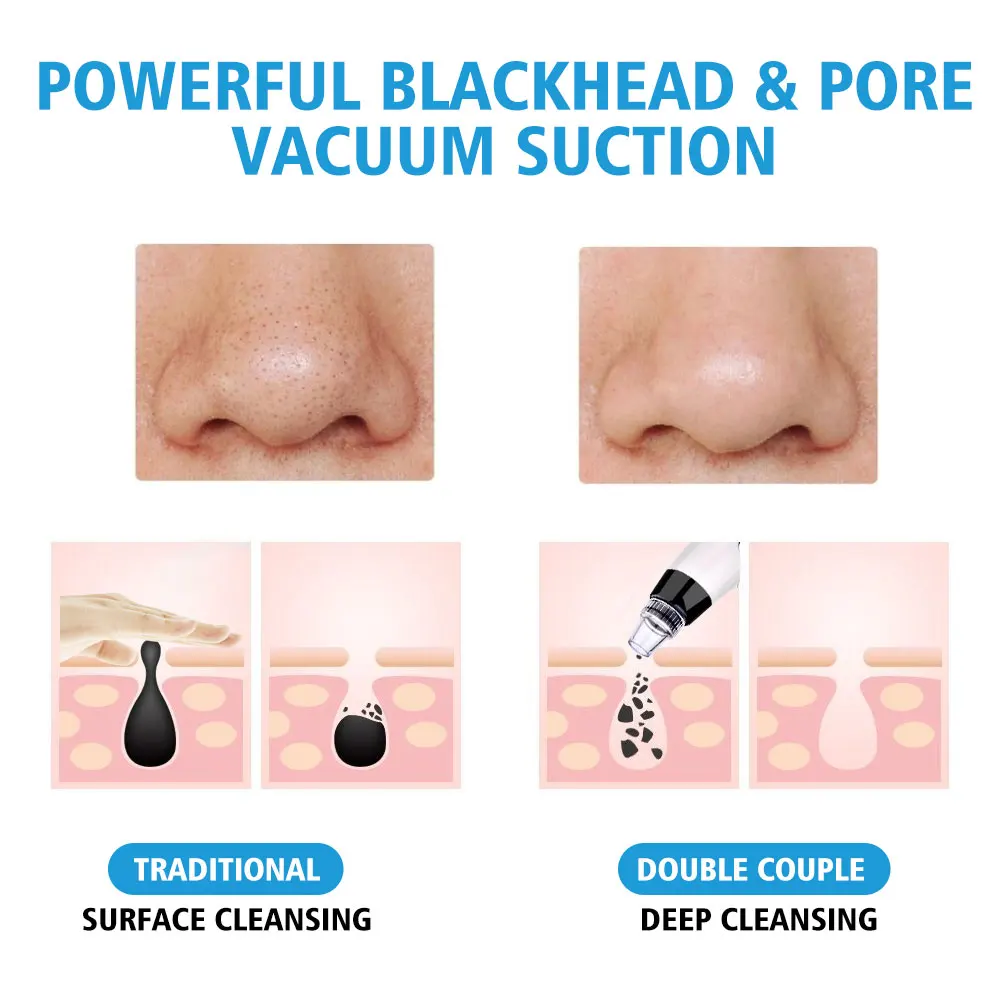 Remoção de Limpador Cravo Elétrico Rosto Limpo Nariz t Zona Poros Vácuo Acne Espinha Removedor Sucção Facial Dermabrasion 11 Powered Dispositivos De Limpeza Facial