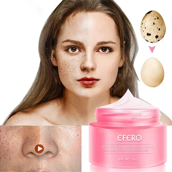 

Hot 30g Remove Stain Face Freckles Cream Skin Whitening Cream Reduces Age Spots Fade Dark Spots Treatment