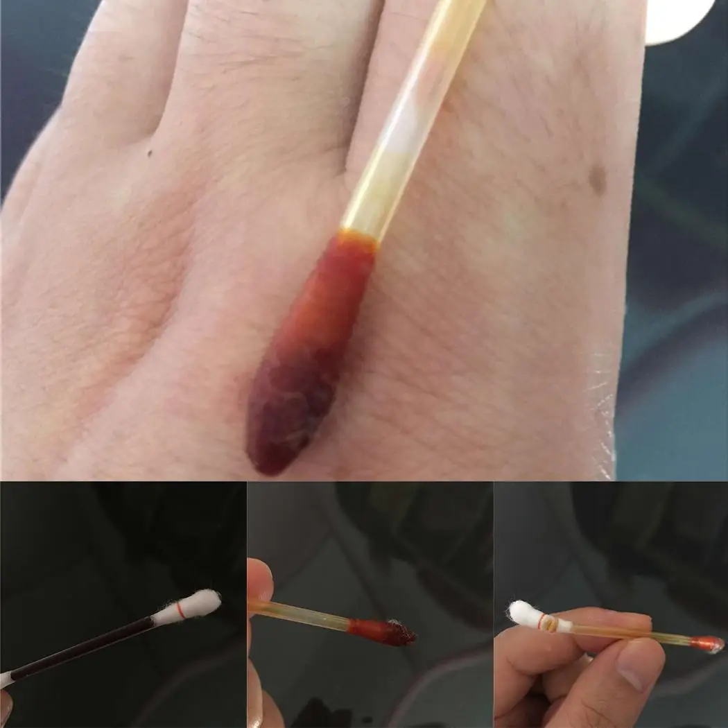 thumb