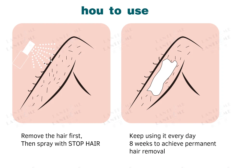 3 шт. ингибитор роста волос депиляция гладкое тело удаление волос спрей депилятор безболезненное лобковое средство для удаления волос на лице для женщин и мужчин