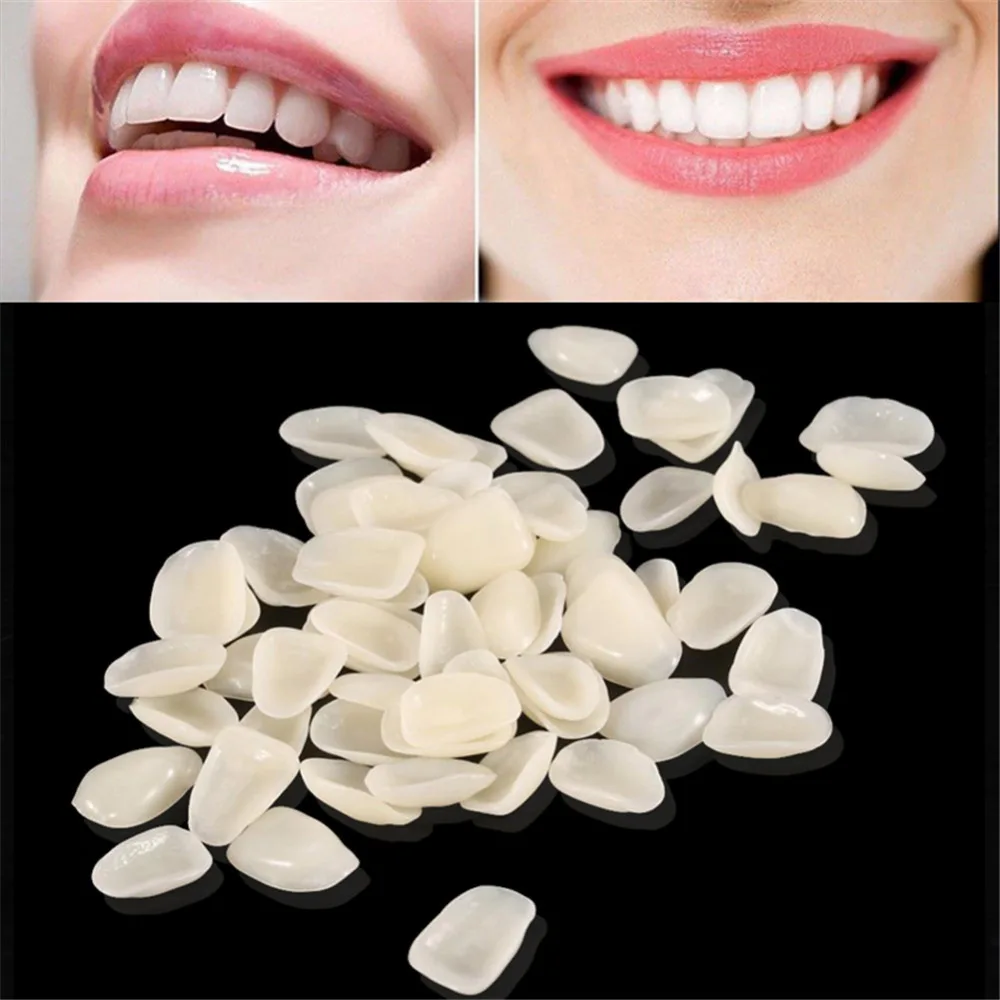 

50Pc/Pack Dental Teeth Veneers Ultra Thin Whitening Resin Anterior Upper Temporary Crown Porcelain Dental Material Oral Care M2