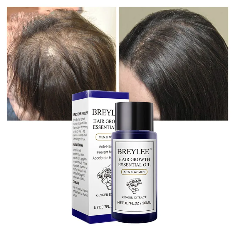 Manooby масло для роста волос от потери истончение лечение стимулирует и быстрее растущие волосы 20 мл