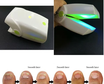 

lllt handheld rechargeable cold laser therapy device for nail finger fungus treatment no pain no side effect CE