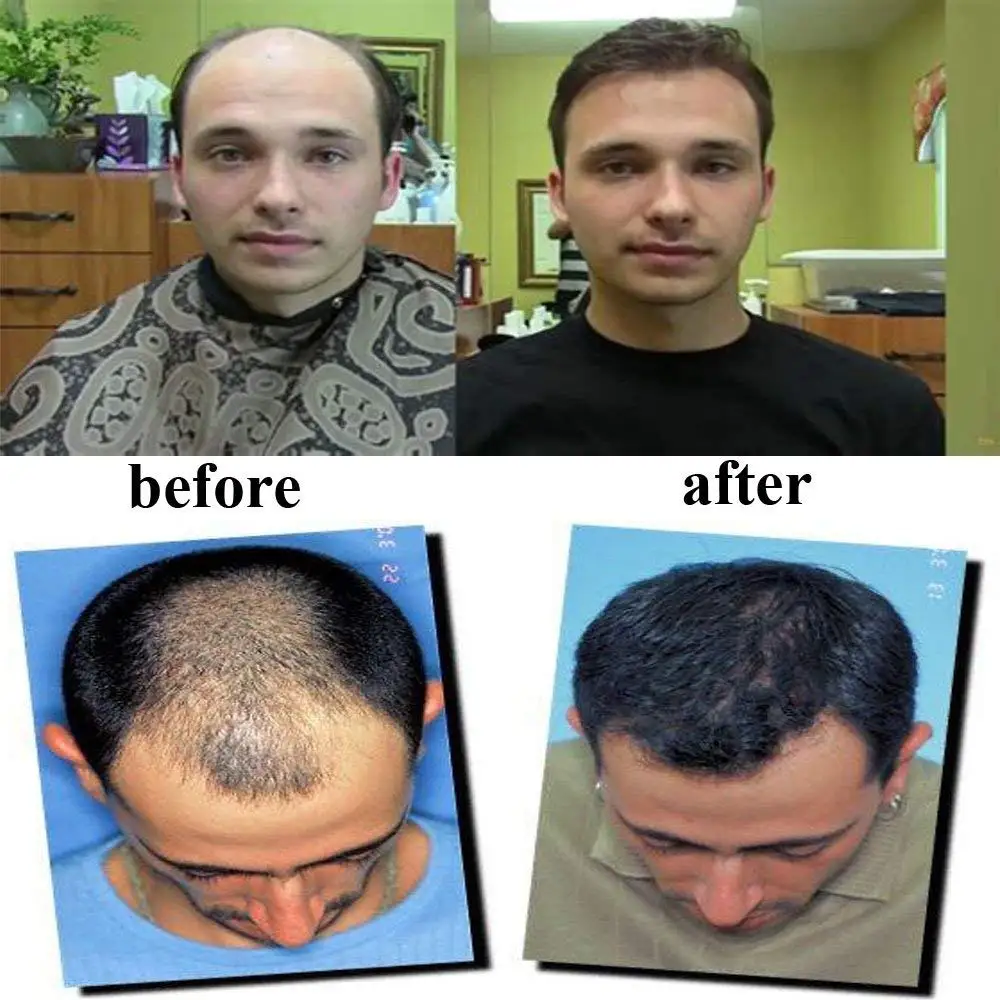Эвершелковистые прозрачные супер тонкие нехирургические мужские волосы remy, система 0,06 мм, накладные волосы для мужчин, Т-образная система, мужской парик