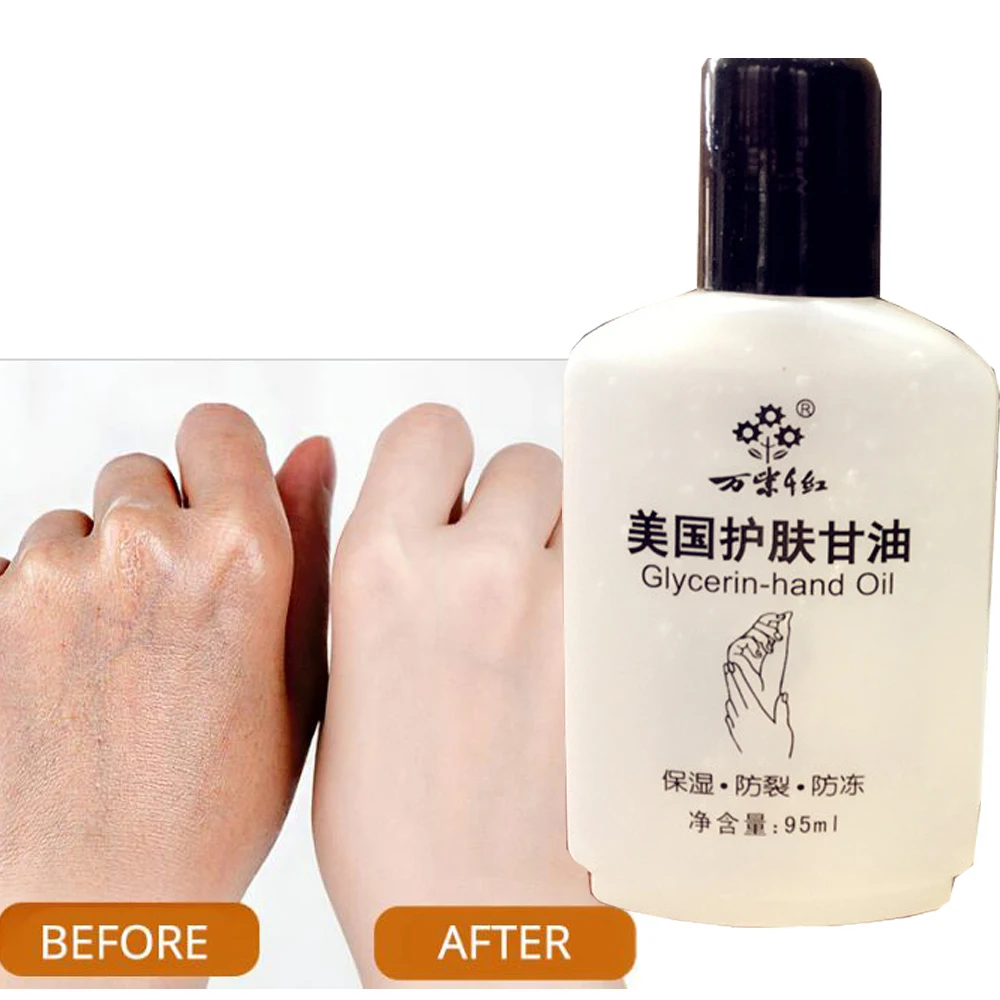 

American Glycerol Moisturizing Body Care Hand Foot Whitening Hydration Soothing Body Lotion Face Toner Skin Care Sunscreen Oil