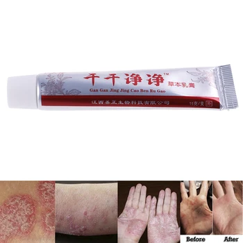 

Chinese Herbal Skin Topical Antipruritic Ointment Cream Analgesic Balm Ointment Psoriasis Cream Body Massage Patches