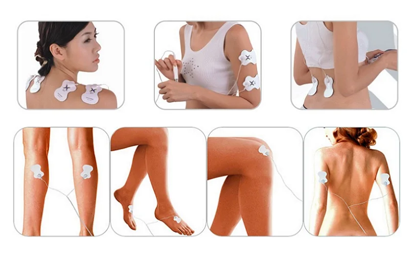 Electrical stimulator