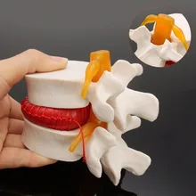 Anatomia człowieka szkielet kręgosłupa dysk lędźwiowy przepuklina model nauczania mózg czaszka traumatyczne pistolet szkolne medyczne instrume