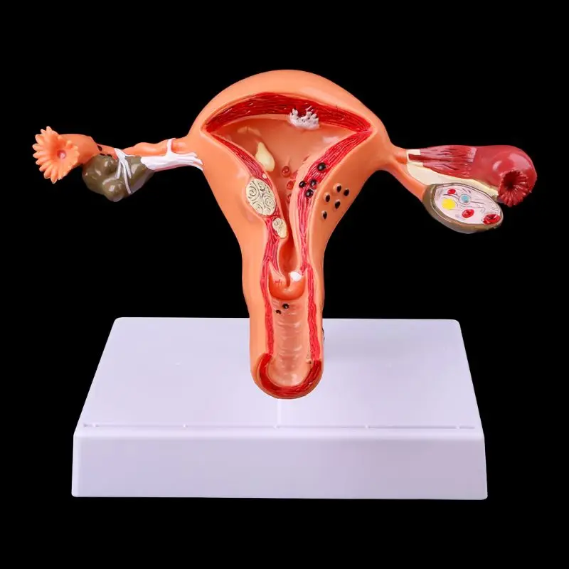

Medical Science Accessories Pathological Uterus Ovary Anatomical Model Anatomy Cross Section Study Tool dropshipping