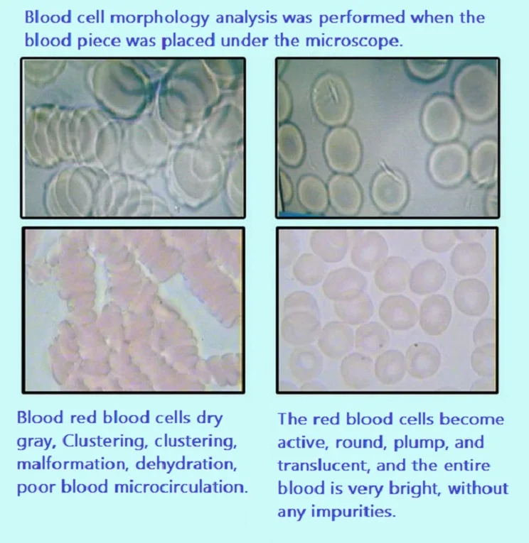 Blood cell test contrast