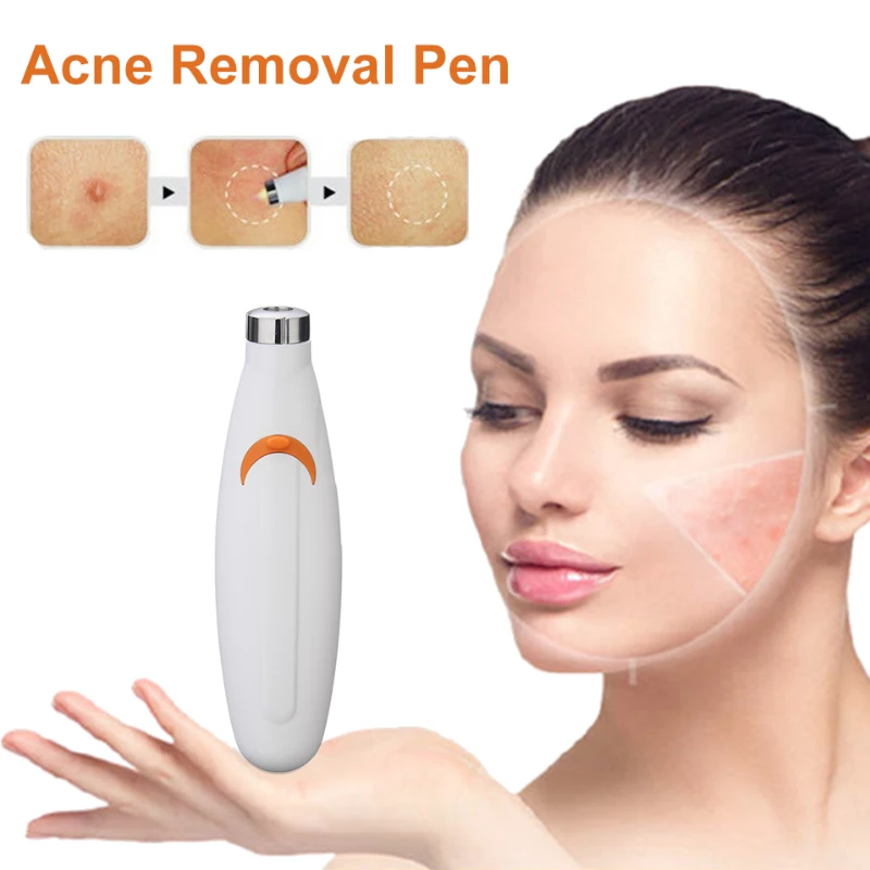 Acne Treatment Pen Face Laser Acne Scar Blemish Light Skin Rejuvenation