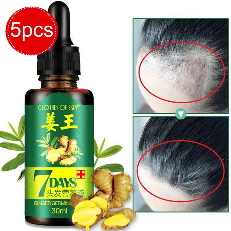 

5pcs Hair Growth Serum Essence for Women and Men Anti preventing Hair Loss alopecia Liquid Damaged Hair Repair Growing Faster