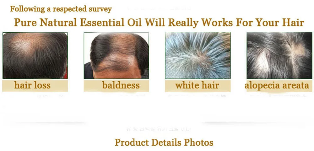 Дропшиппинг Уход за волосами для роста волос Эфирные масла эссенция подлинный выпадение волос жидкость уход за здоровьем красивые, густые волосы
