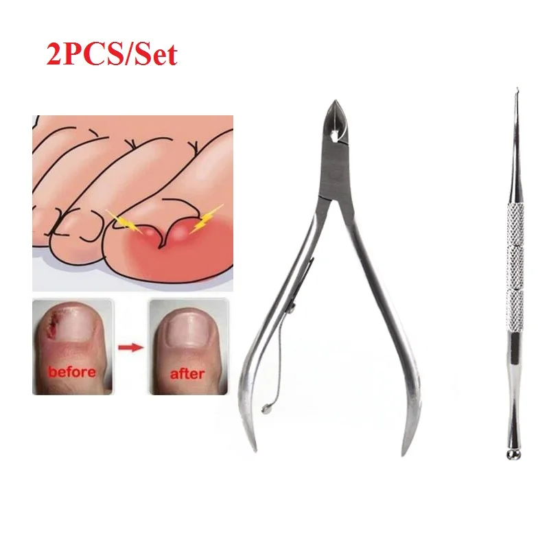 

2PCS Ingrown Foot Care Tool Toe Nail Correction Nippers Clipper Cutters Dead Skin Dirt Remover and Paronychia Podiatry Pedicure