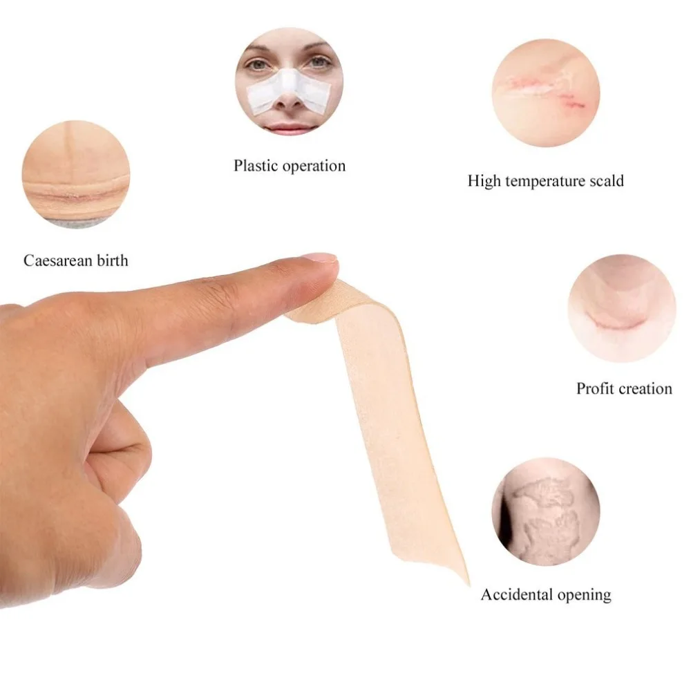 Эффективная хирургии силиконовый гель шрама лист терапии патч 3,5x15 см для акне "ожог восстановления кожи удаление шрам