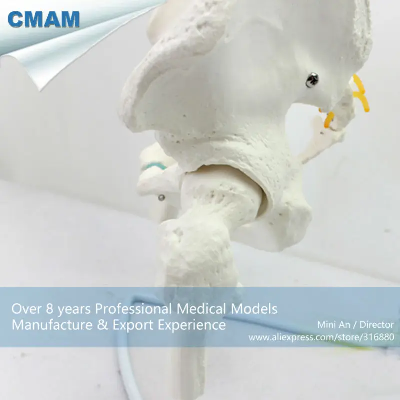 CMAM/12376 позвоночник, таз, прозрачный синий межпозвонковый диск, бедренная голова, медицинская спинальная Колонка анатомическая модель человека