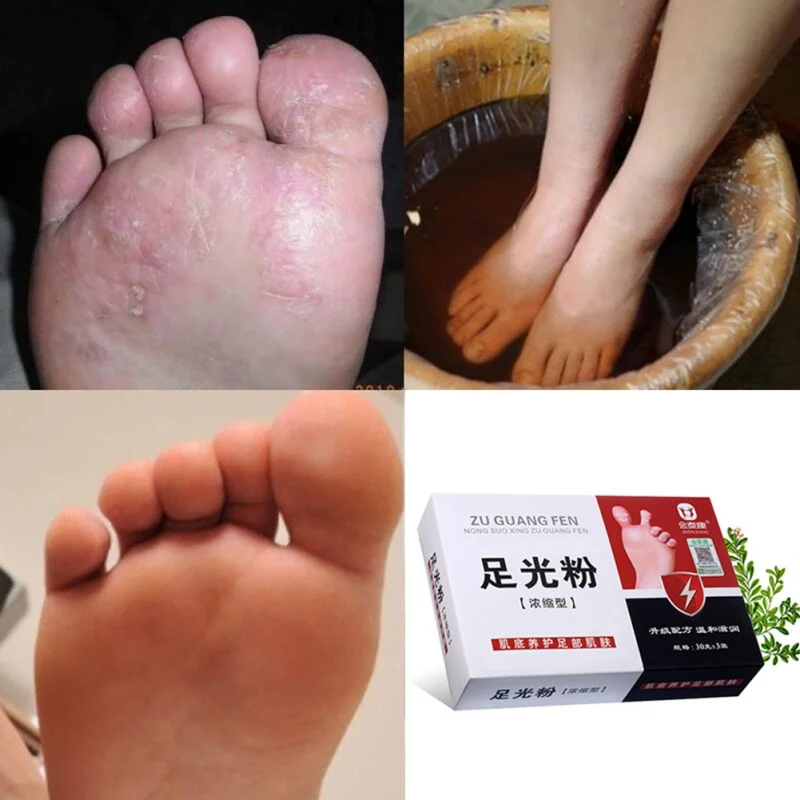 3 Bags Foot Bath Powder Anti Beriberi Feet Care Athlete's Foot, Foot