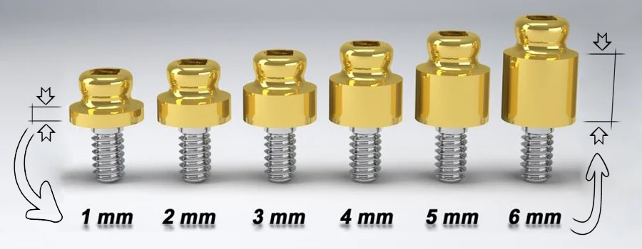 Abutment details