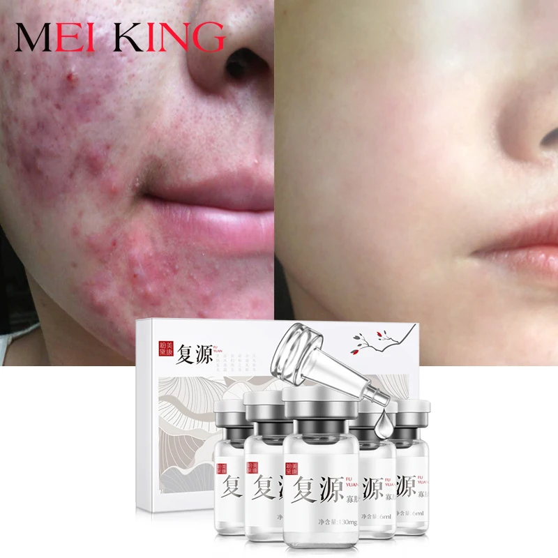 

MEIKING Oligopeptide Serum Face Cream Acne Treatment Skin Care Repair Shrink Pores Anti Aging Winkles Essence Moisturizing 8pcs