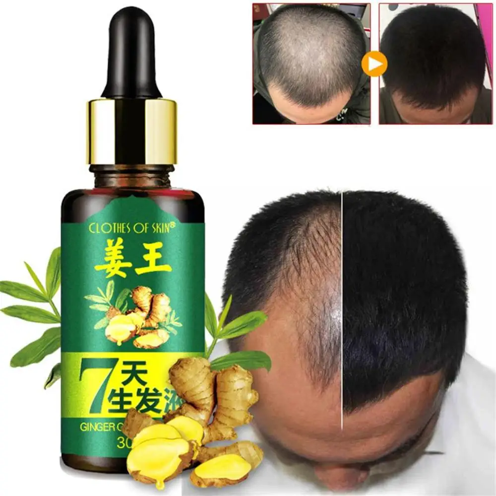 30ml Women Men Hair Care Growth Essence Liquid Fast Restoration