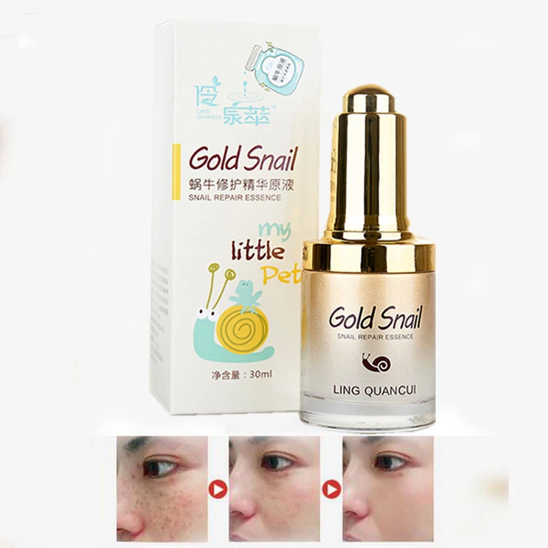 korean cosmetics for acne