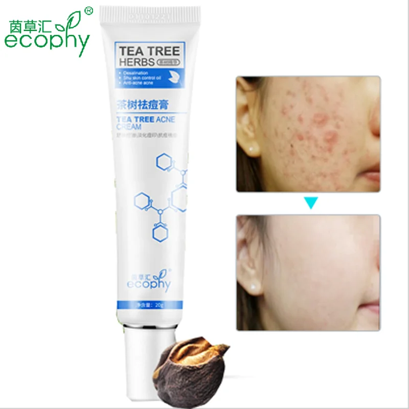 Крем для лица Tea Tree отбеливающий крем с черными точками от угрей и акне 20 мл|skin