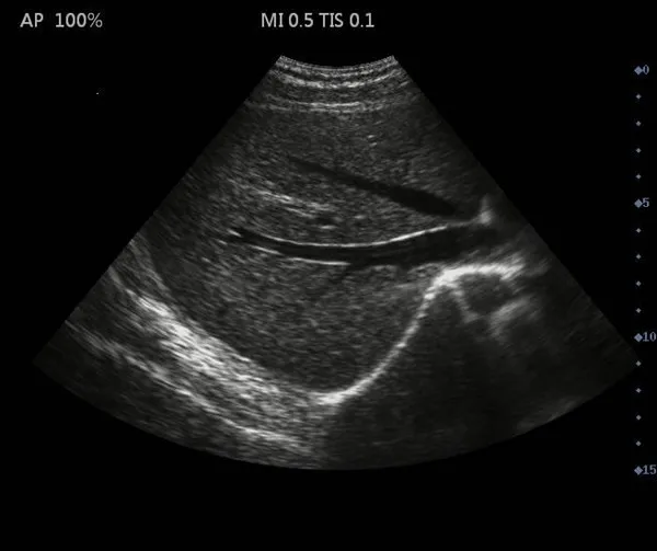 Portable-ultrasound-scanner-Laptop-type-ultrasound-SS (4)