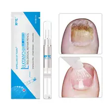 Китайская травяная грибковая ручка для лечения ногтей Уход за ногами отбеливающая эссенция для удаления грибка ног против инфекции