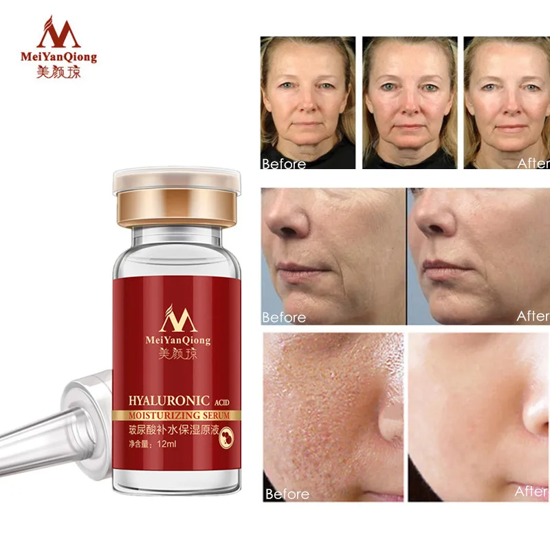 hyaluronic acid face moisturiser