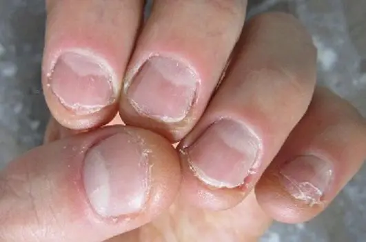 No Bite Stop Nail Cuticle Biting Polish Bitter Best For Child Non No Bite Stop Nail Cuticle Biting Polish Bitter Best For Child Non Toxic Uni Free Ship In Treatments From Beauty Health On Aliexpress Alibaba
