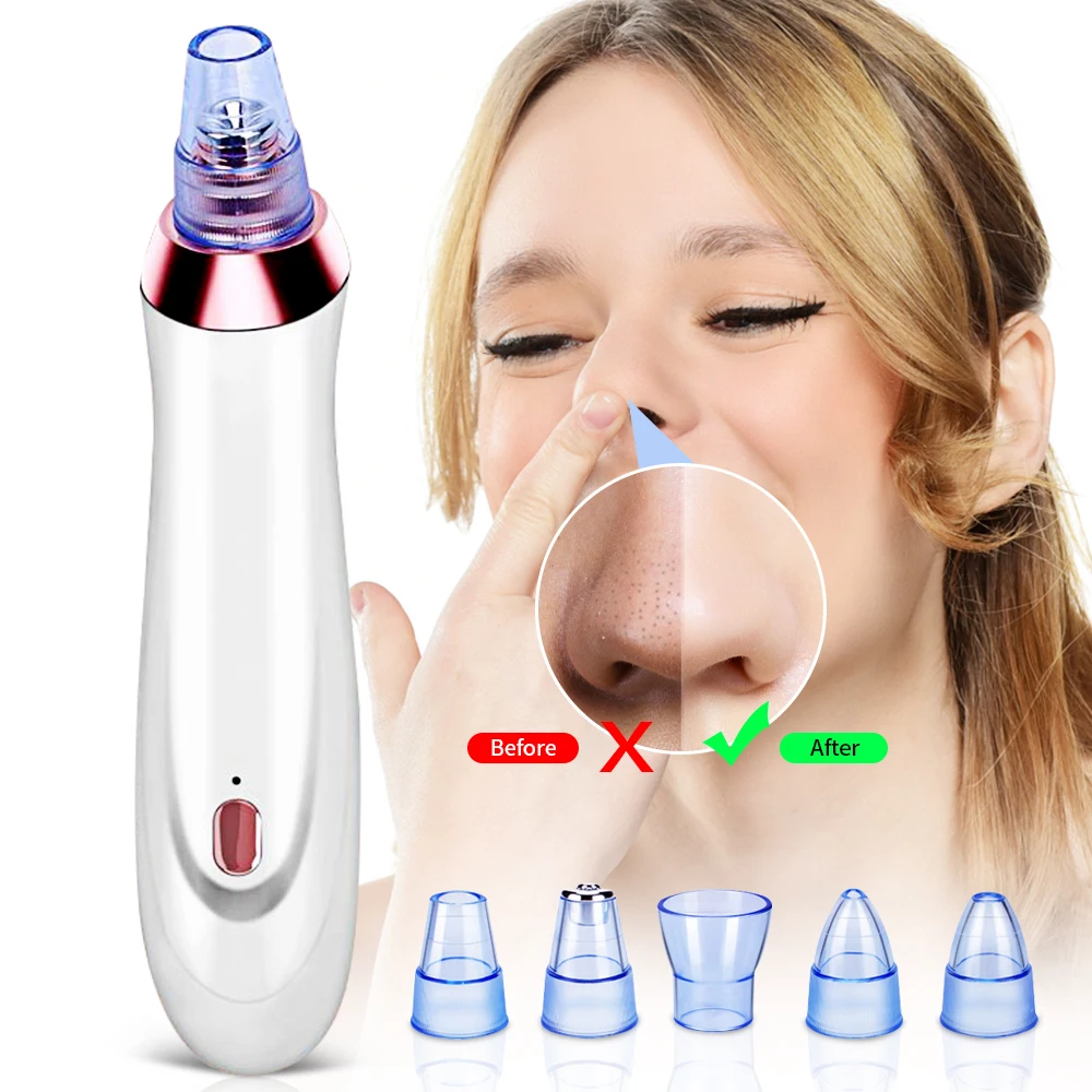 

Blackhead Remover Pore Cleaner Skin Care Pore Vacuum Acne Remover Pimple Removal Vacuum Facial Face Clean