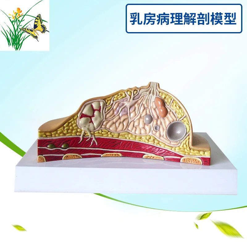

Breast Disease Breast Anatomy Model Human Body Model Anatomical Human Pathological Breast Model Medical Disease & Cancer Anatomy