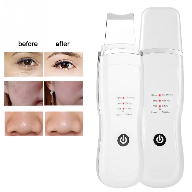 

Ion Skin Scrubber Ultrasonic Deep Cleansing Face Skin Cleaner Charging Device Blackhead Removal Exfoliating Pore Cleaner Tools