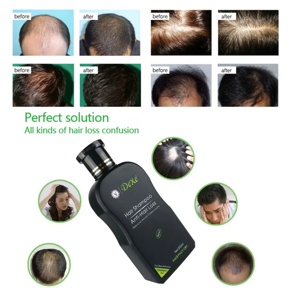 

Hair Shampoo Set Anti-hair Loss Herbal Hair Growth Product Prevent care