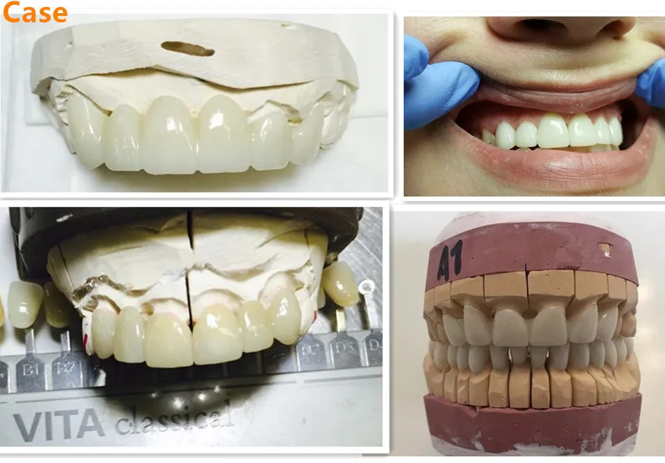 Bloco de Zircônia ht para Completo Dental 7 Bloco dental do ht da zircônia para o circuito completo