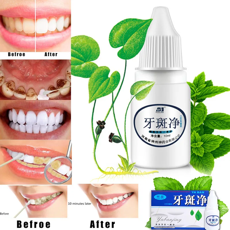Отбеливающая жидкость для зубов Гигиена полости рта очищающая жидкость для ухода за зубами CD88