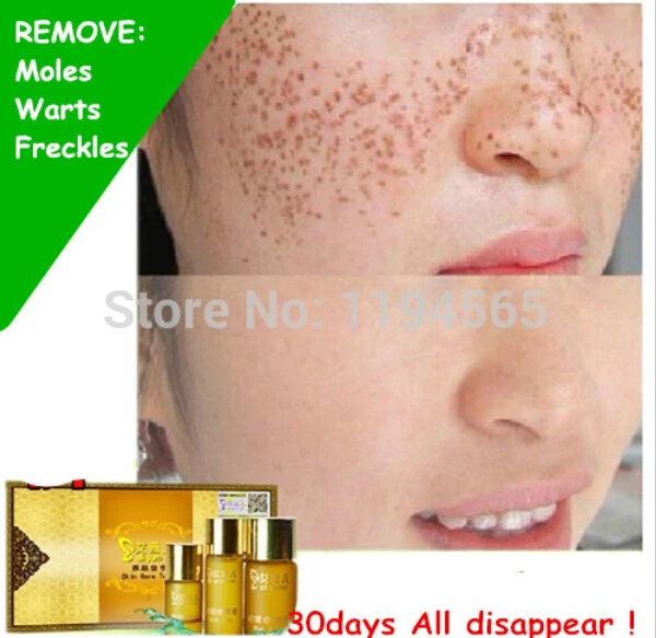 Image Sploshes Drops Facial Cream Speckles Freckles remove Seamless Water Warts Remove Moles Removal Free Shipping