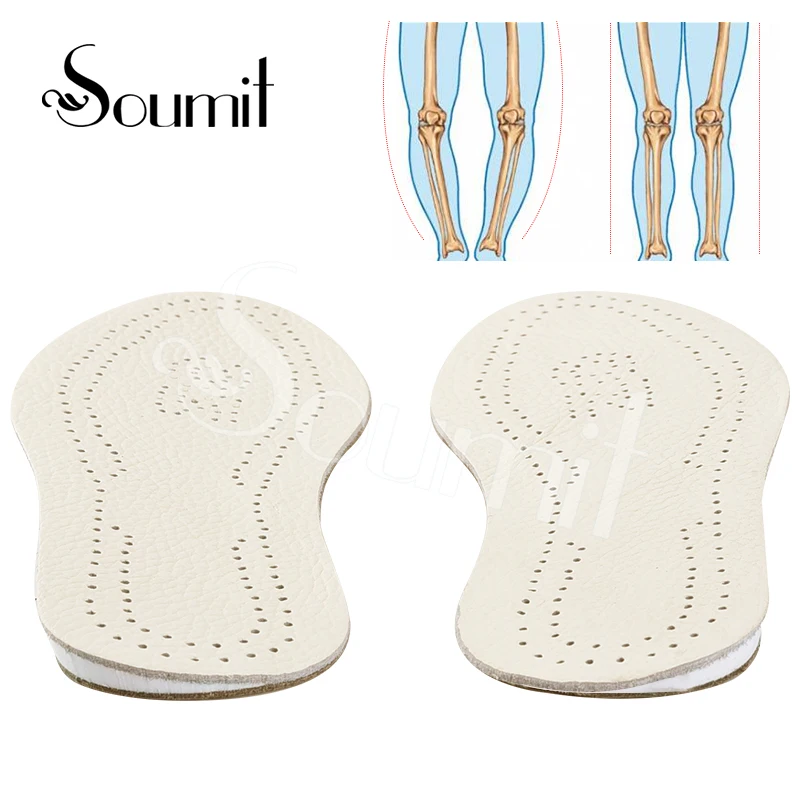 

Soumit Orthopedic Insoles for Shoes O/X Type Leg Correction Insert Pad Cowhide Leather Outside Inside Shoe Pad for Men Women