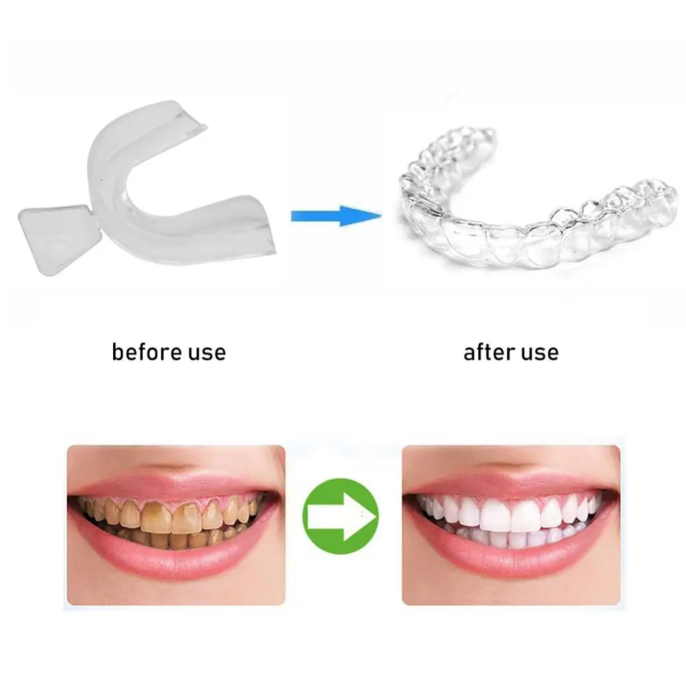 Где Купить Капы Для Зубов В Аптеке