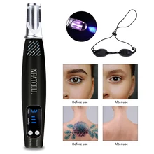 Лазерная машинка-карандаш для удаления татуировок синий светильник терапия пигмент шрам моль бровь тату удаление темных пятен машина Picosecond ручка