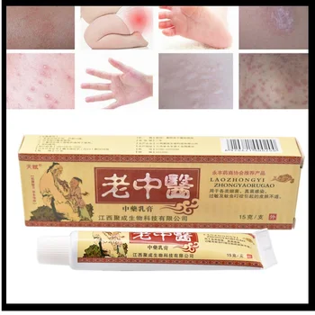 

No box YIGANERJING laozhongyi 100% Original Powerful Professional Cure Psoriasis Ointment Native Medicine Ingredient Security