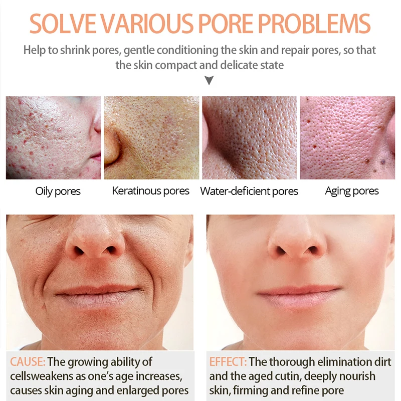 Яркая Гламурная acide salicylique Сыворотка для лица сужающая поры увлажняющая