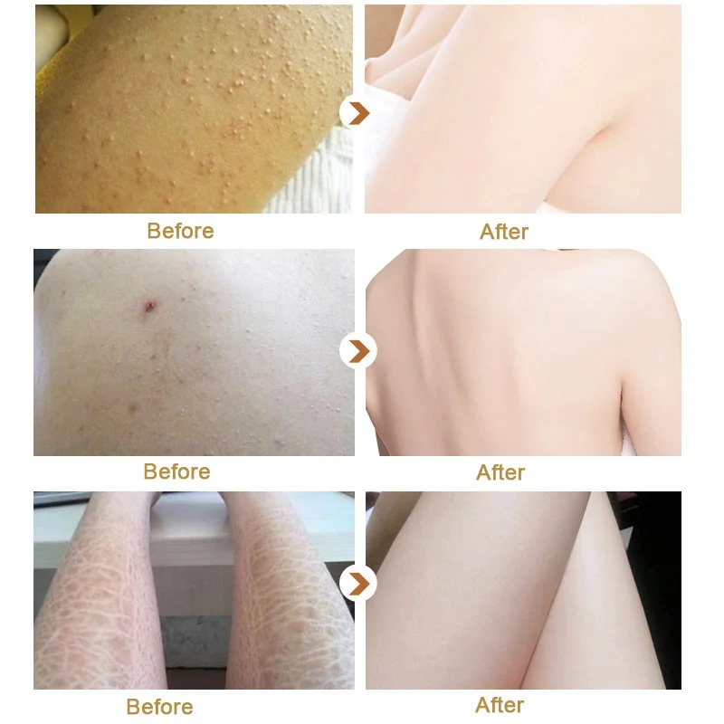 Косметическое восстанавливающее масло для кожи 30 г Натуральный Уксус омоложение лица Эфирное масло для ухода за кожей