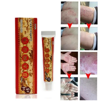 

High Quality Natural Chinese Medicine Herbal Anti Bacteria Cream Psoriasis Eczema Ointment Treatment Herbal Cream 15g D179