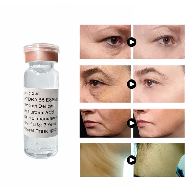 Унисекс, маска для удаления угрей нос эссенция для лица прокладки поры ретинол B5, для лечения прыщей, черная глубокое очищение уход за кожей