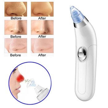 

Nose Vacuum Suction Blackhead Remover Nose Facial Pore Cleaner Spot Acne Black Head Pimple Remover Beauty Face Skin Care Tool