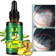 30 мл эссенция для роста волос против выпадения волос Китайский травяной продукт для роста волос для мужчин и женщин