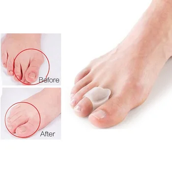 2Pcs=1Pair Orthopedic Toe Separators Valgus Pro Corrector Overlapping Straightener Foot Massage Pedicure Device Bunion Protector