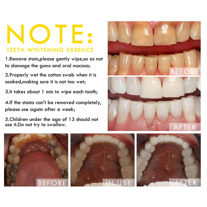 Отбеливание зубов эссенция ментол гигиена полости рта Чистка удаляет пятна налета зуб YUF99