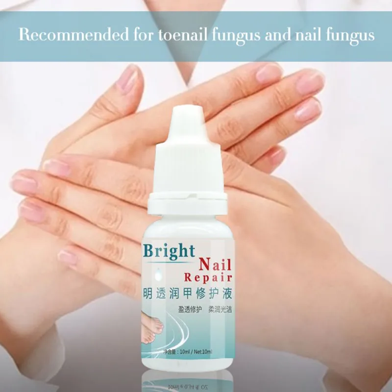 Kills 99.9% Bacteria Nail Fungus Oil Nail Care Treatment Onychomycosis Paronychia Anti Fungal Nail Infection repair nails 10ml